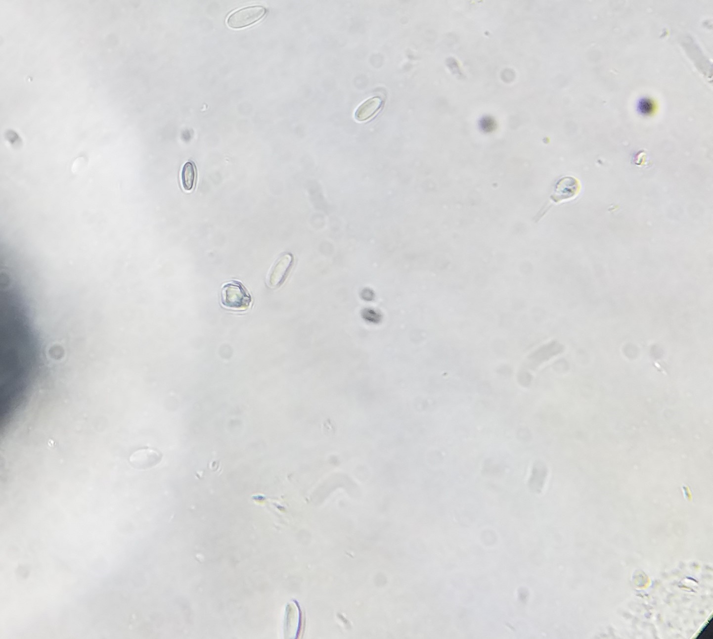 Hypomyces Chrysospermus Figure 2